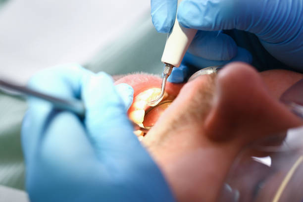 Best Emergency Gum Treatment in Spindale, NC
