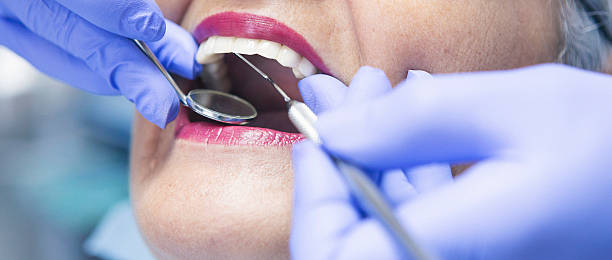 Best Emergency Tooth Extraction in Spindale, NC